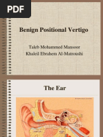 Bppv Vertigo Auditory System