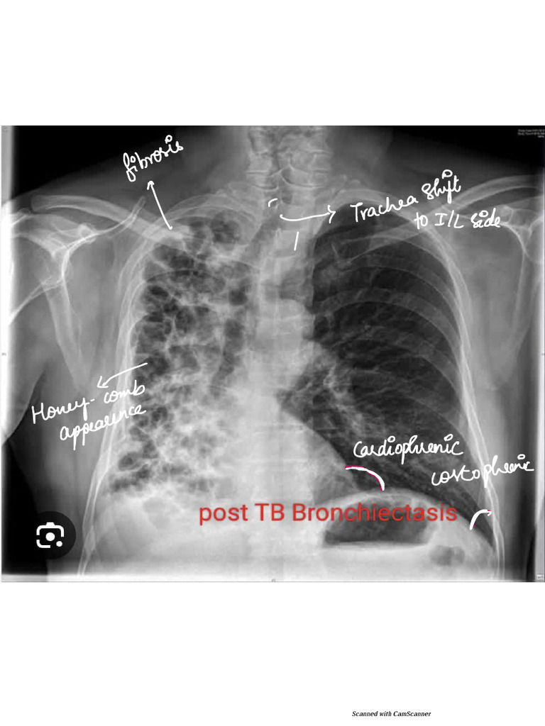 GM X-Rays | PDF