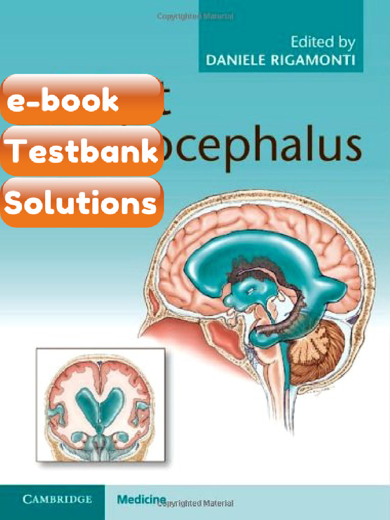 Testbank Adult Hydrocephalus Cambridge Medicine Fast Download | PDF ...