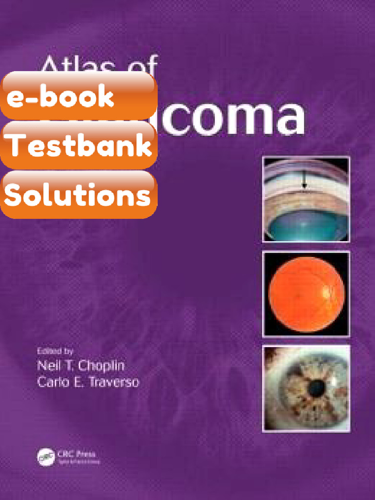Testbank Atlas of Glaucoma Third Edition Fast Download | PDF | Glaucoma ...
