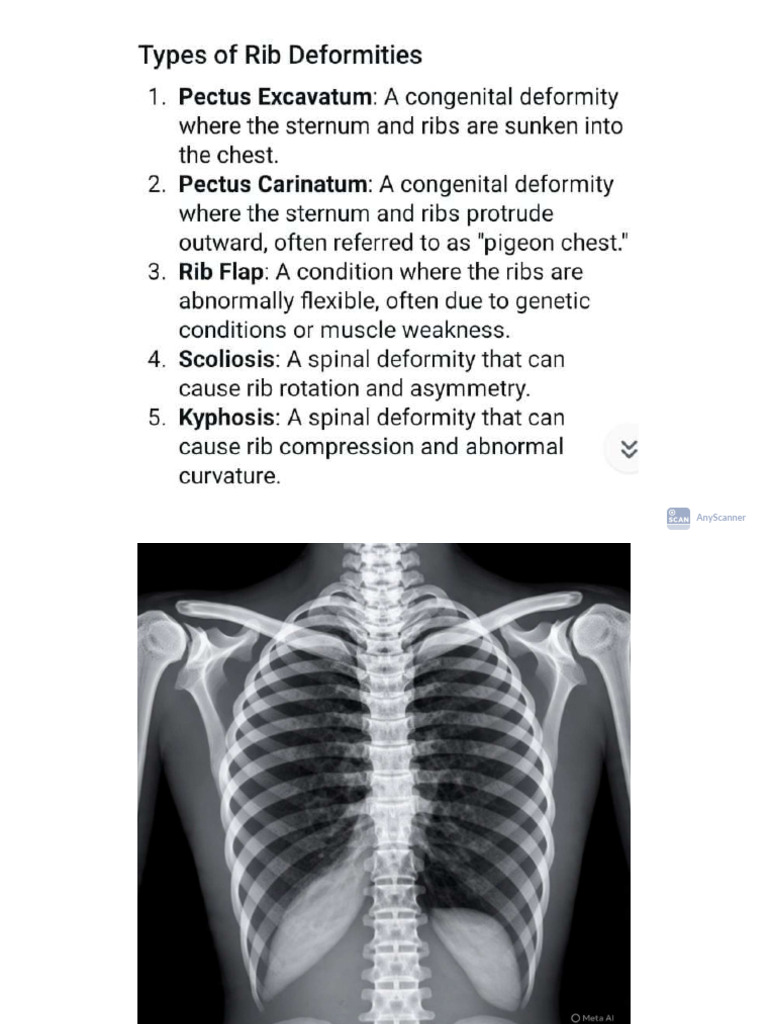 Ribs Radiography.. | PDF