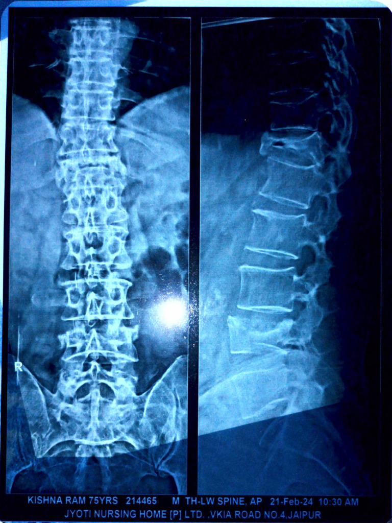 x-ray | PDF