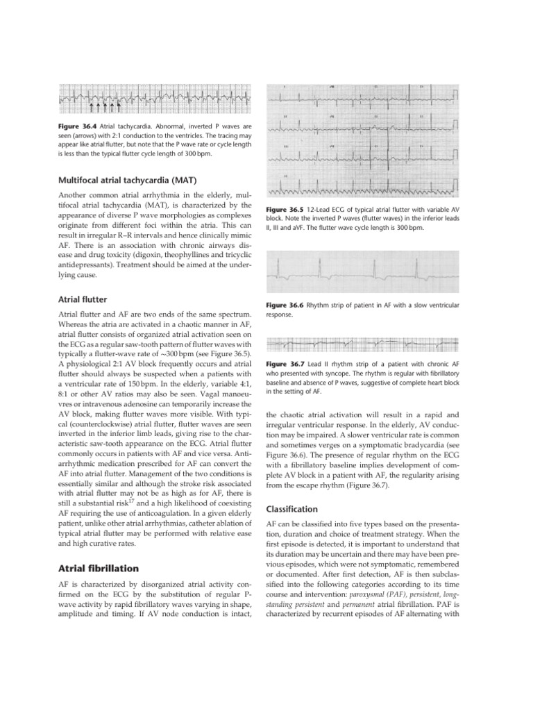 Af Af | PDF
