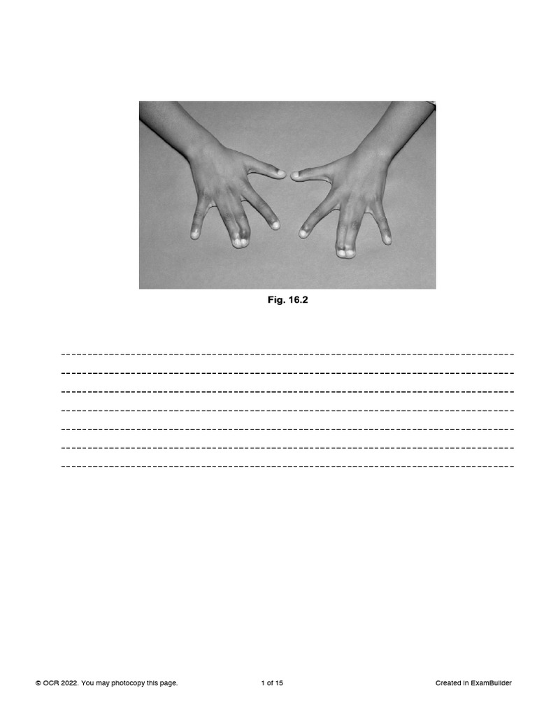 6.1.1 Development of Body Plans | PDF | Gene | Genetics