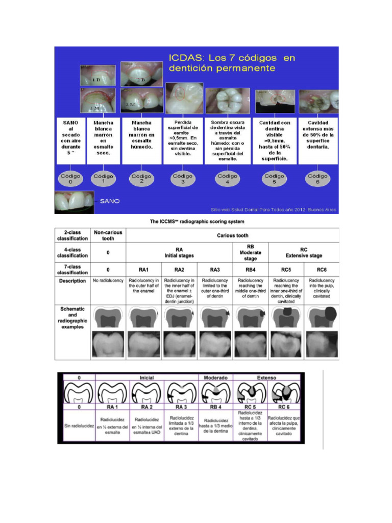Clasificación Icdas Radiografico y Clinico | PDF
