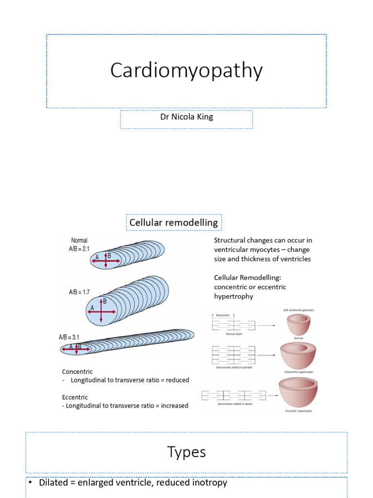Cardiomyopathy Heart Failure | PDF | Heart | Heart Failure