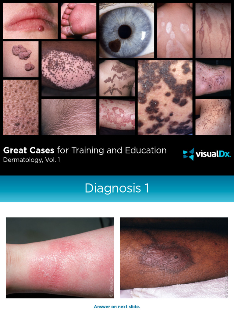 Great Cases For Dermatology Vol 1 | PDF