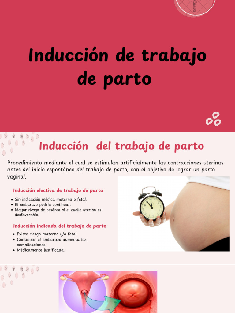 Inducción y Conducción Del Trabajo de Parto | PDF | Parto | El embarazo
