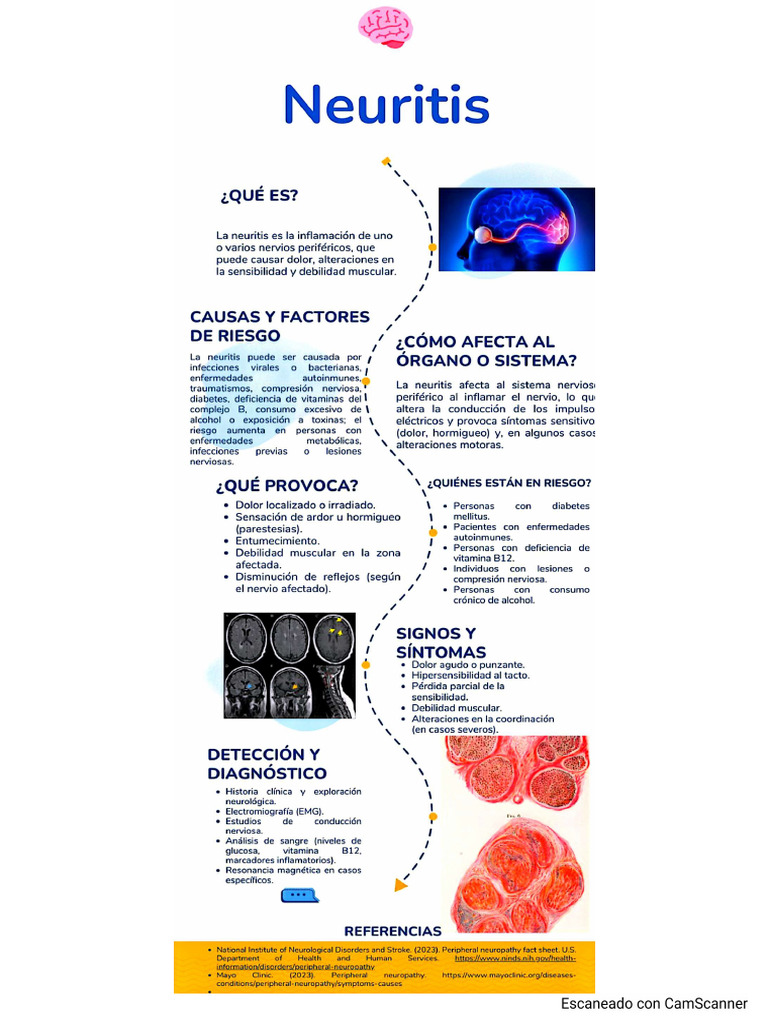 Neuritis | PDF