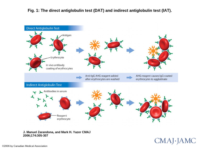 Fig. 1: The Direct Antiglobulin Test (DAT) and Indirect Antiglobulin ...