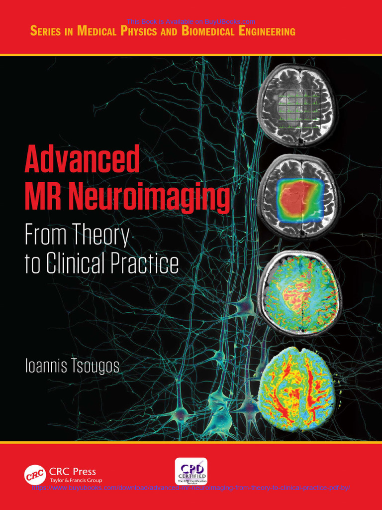 Advanced MR Neuroimaging From Theory To Clinical Practice (PDF) by PDF ...