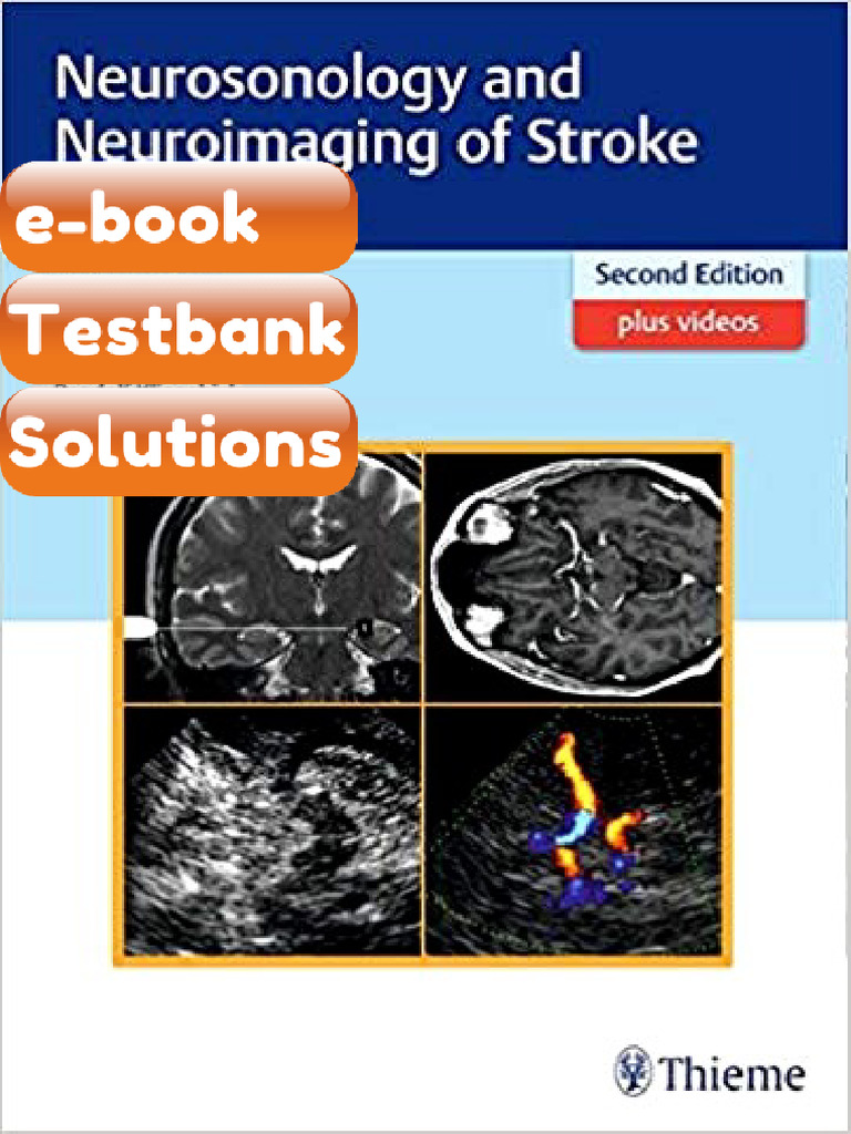 Testbank - Neurosonology and Neuroimaging of Stroke 2nd Edition 1st ...