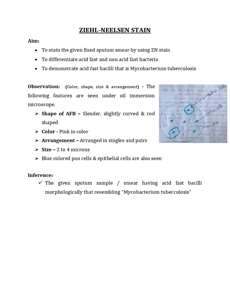 ZN Stain Practical | PDF