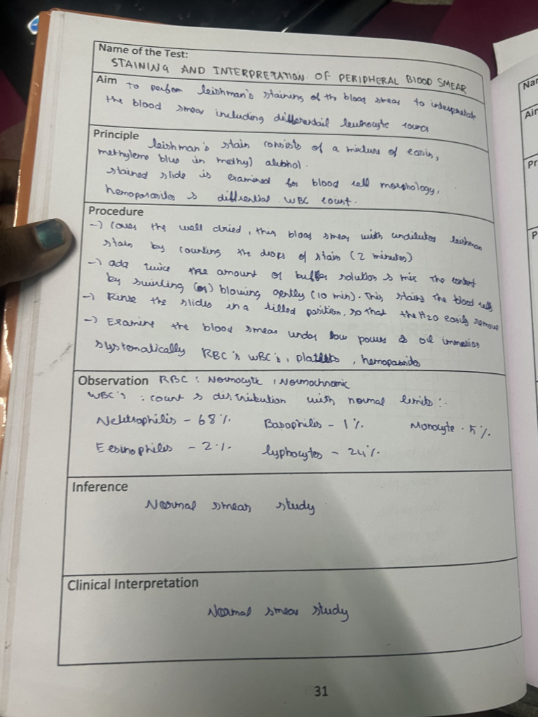Experiment | PDF