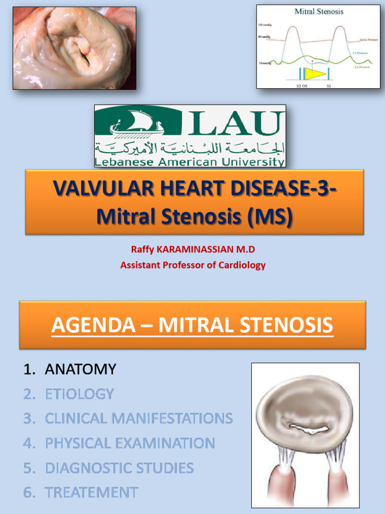 VALVULAR - 3-MS (Light) | PDF | Heart Valve | Heart