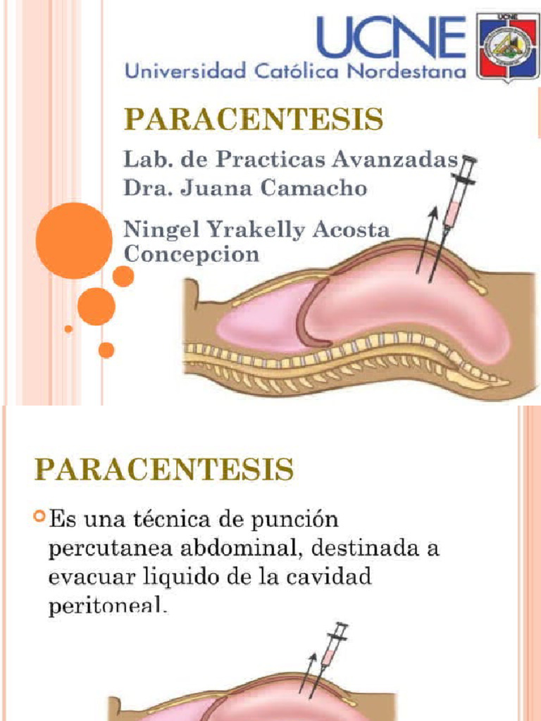 Paracentesis | PDF