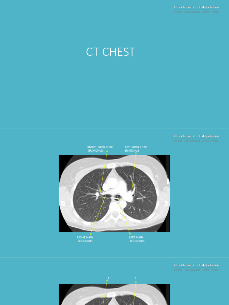 Study Material Anatomy CT CHEST | PDF | Aorta | Common Carotid Artery