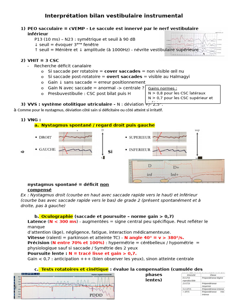 Interprétation VNG | PDF | Système nerveux