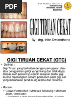 Download Gigi Tiruan Cekat by Mila Ajah SN99940932 doc pdf