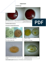 Identifikasi Bakteri Gram Positif dan Negatif