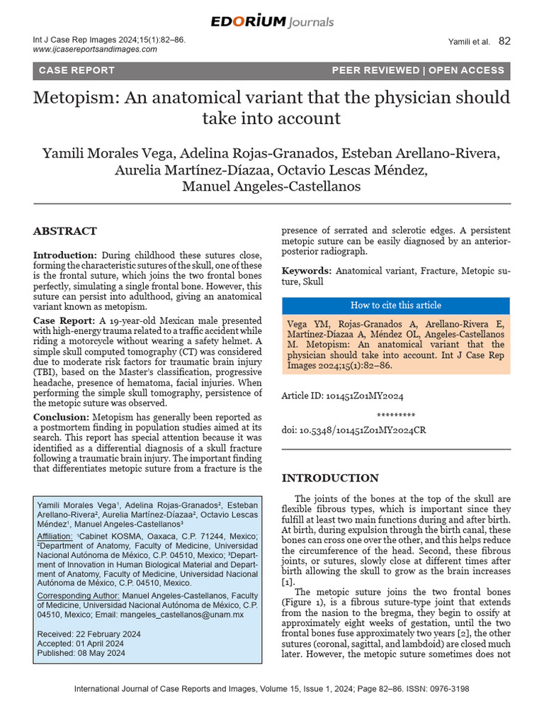 Metopism An Anatomical Variant | PDF | Traumatic Brain Injury | Skull