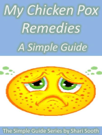 My Chicken Pox Remedies: A Simple Guide