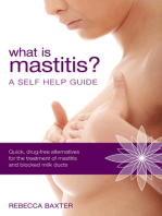 What is Mastitis? A Self Help Guide
