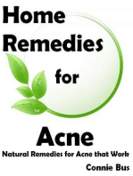 Home Remedies for Acne: Natural Remedies for Acne that Work