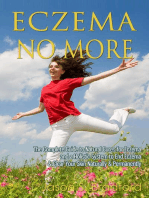 Eczema No More: The Complete Guide to Natural Cures for Eczema and a Holistic System to End Eczema & Clear Your Skin Naturally & Permanently