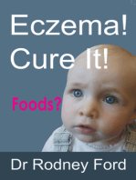 Eczema! Cure It!