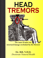 HEAD TREMORS, the cause of mine overlooked by Doctors
