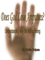 Does God Love Amputees?