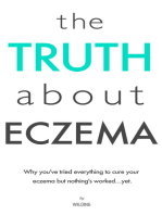 The Truth About Eczema