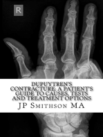 Dupuytren's Contracture: A Patient’s Guide to Causes, Tests and Treatment Options