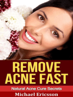 Remove Acne Fast: Natural Acne Cure Secrets