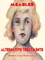 Measles Alternative Treatments