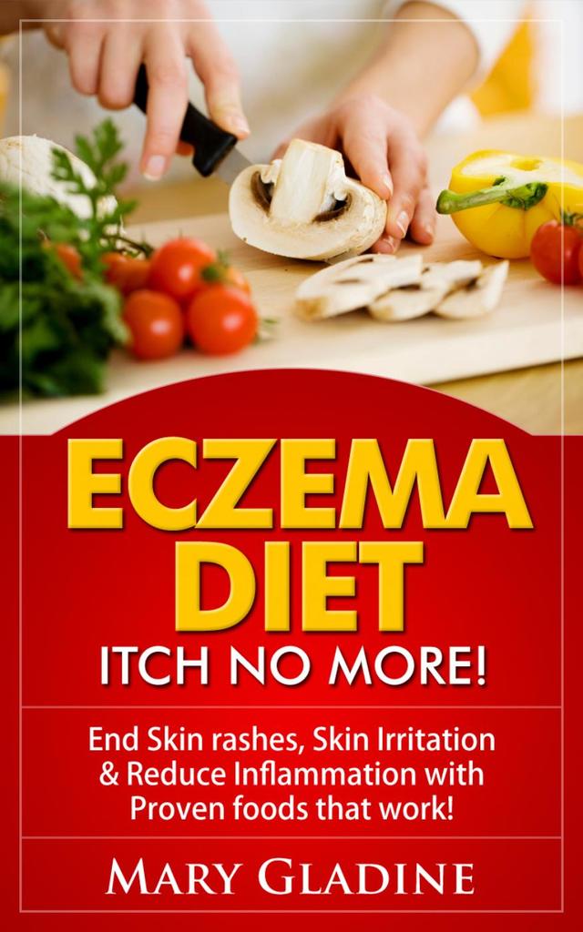 Read Eczema Diet Itch No More! End Skin rashes, skin irritation