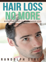 Hair Loss No More: Effective Ways To Treat Hair Loss