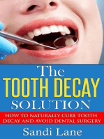 The Tooth Decay Solution