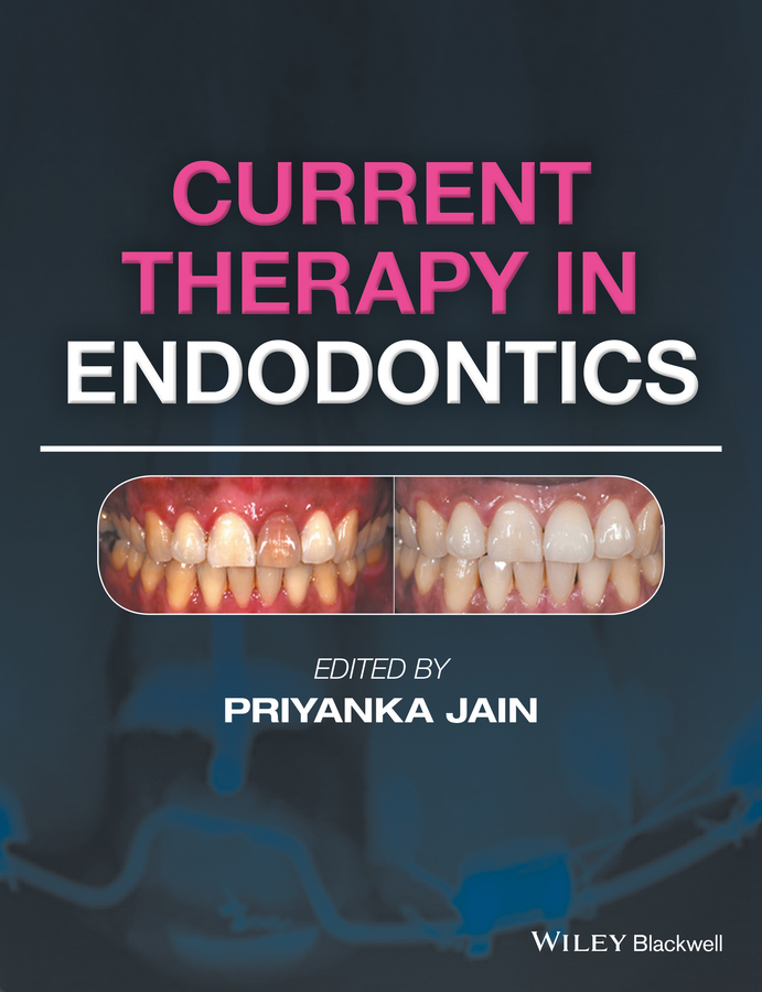 Current Therapy in Endodontics Book Read Online