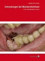 Erkrankungen der Mundschleimhaut: in der zahnärztlichen Praxis