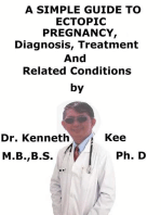 Ectopic Heartbeats, (Extrasystoles) A Simple Guide To The Condition, Diagnosis, Treatment And Related Conditions