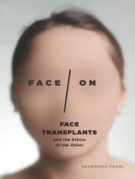 Face/On: Face Transplants and the Ethics of the Other