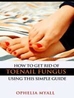 How to Get Rid of Toenail Fungus Using This Simple Guide