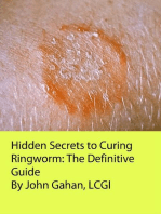 Hidden Secrets to Curing Ringworm