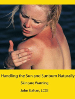 Handling the Sun and Sunburn Naturally: Skincare Warning