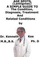 Age Spots (Lentigines), A Simple Guide To The Condition, Diagnosis, Treatment And Related Conditions