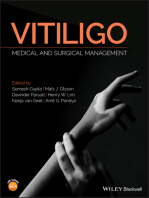 Vitiligo: Medical and Surgical Management