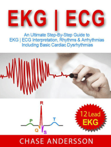 Read Ekg Ecg An Ultimate Step By Step Guide To 12 Lead Ekg Ecg Interpretation Rhythms Arrhythmias Including Basic Cardiac Dysrhythmias Online By Chase Andersson Books