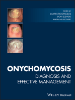 Onychomycosis: Diagnosis and Effective Management
